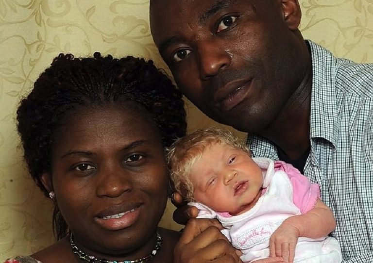 The mystery of the Black couple who gave birth to a white baby