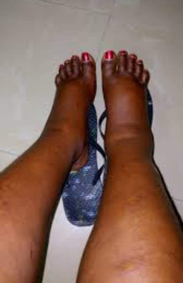 MASAITI FEMALE TEACHER FAILS TO LEAVE STATION AFTER ENCOUNTER WITH VILLAGE CRUSH