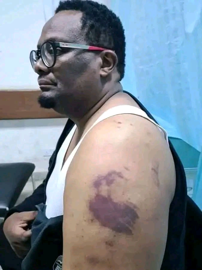 They want to abduct me, cries Amb. Emmanuel Mwamba