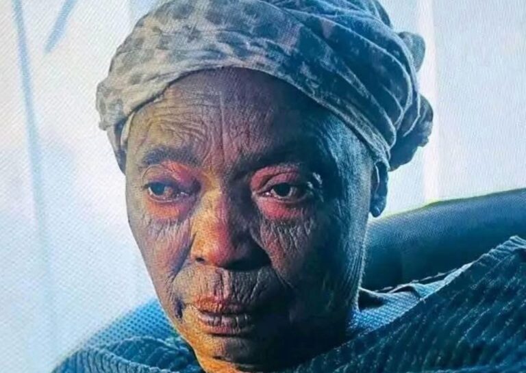 Social Media Erupts in Mockery Over Thabo Bester’s Mother’s Burnt Face