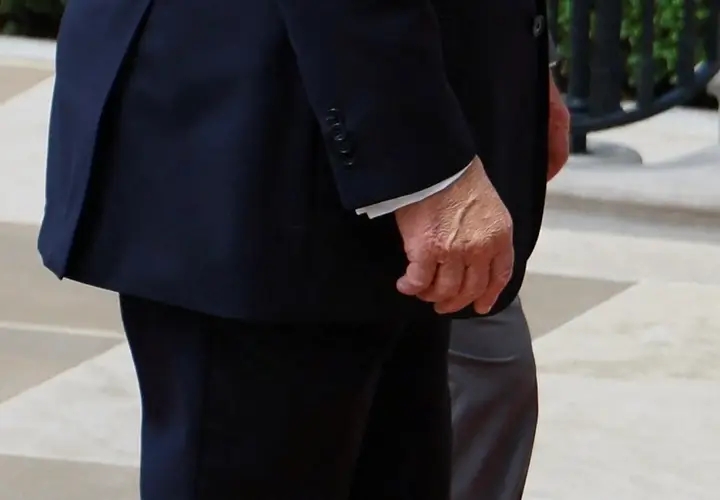Trump’s Hand Spotted Caked in Makeup During King Charles Farewell at White House