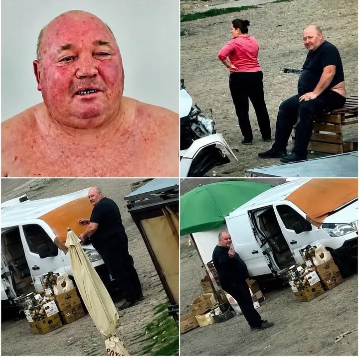 Ukrainian Civilian Survives Reported Russian Drone Attack After Dramatic Escape Captured on Video