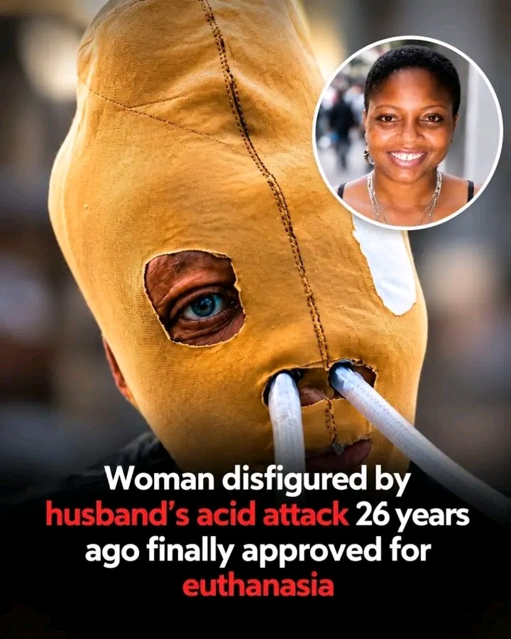 Colombian Acid-Attack Survivor Chooses Life After 26 Years, 87 Surgeries