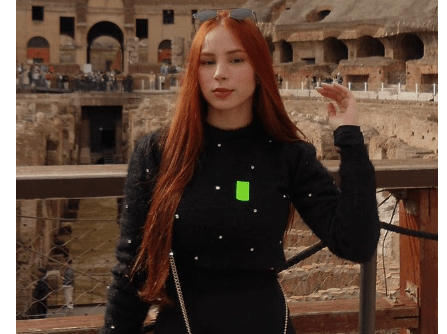Influencer has d!ed at the age of 22, just weeks after she had bre@st reduction surgery.