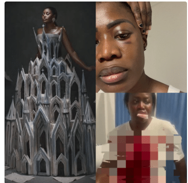 Ghanaian actress Nana Akua Addo hospitalised after allegedly being b@ttered by her husband